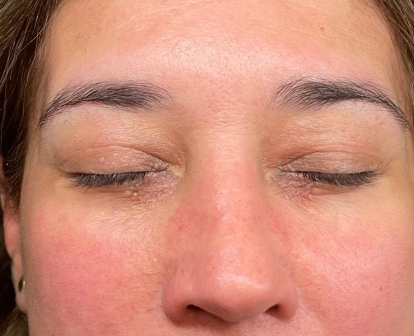 Antes: MICROBLADING | ANTES Y DESPUÉS