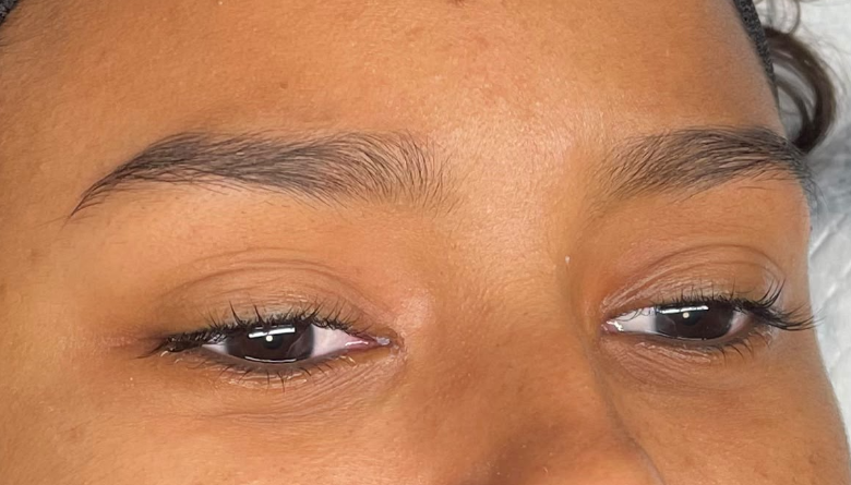 Antes: LINER INFERIOR | ANTES Y DESPUÉS