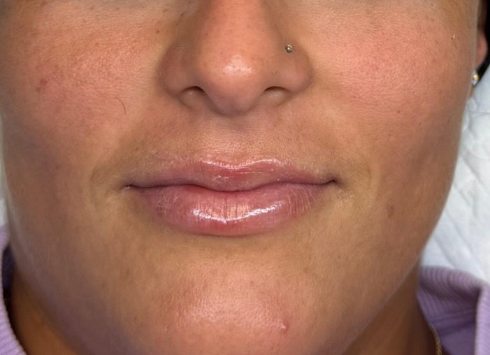 Antes: MICROPIGMENTACIÓN DE LABIOS | ANTES Y DESPUÉS