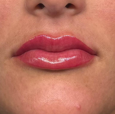Después: MICROPIGMENTACIÓN DE LABIOS | ANTES Y DESPUÉS
