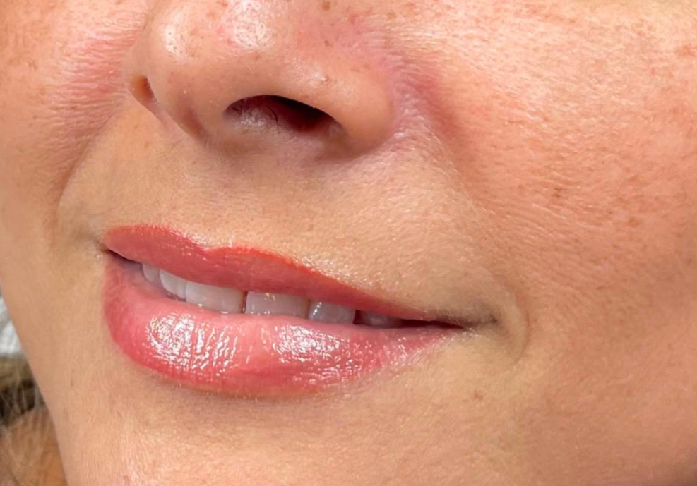 Después: MICROPIGMENTACIÓN DE LABIOS | ANTES Y DESPUÉS