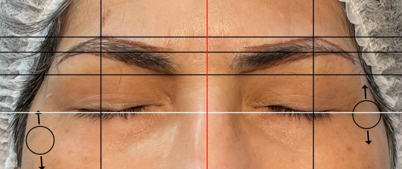 Antes: SHADING | ANTES Y DESPUÉS